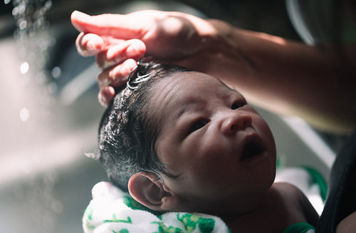 Get Rid of Cradle Cap With This Proven Method